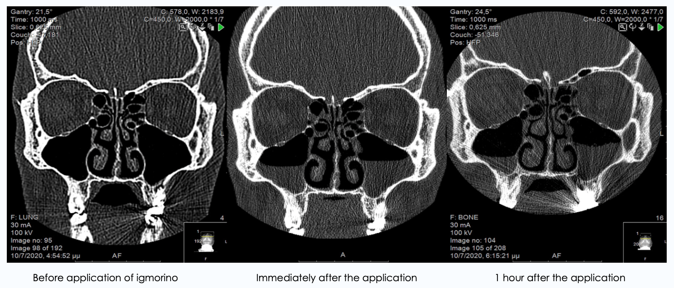 Screenshot 2024-10-21 at 11.43.07 AM